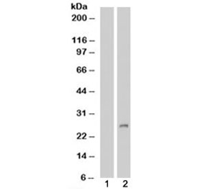 Western blot of HEK293 lysate overexpressing IGFBP6 probed with IGFBP6 antibody (mock transfection in lane 1). Predicted molecular weight: ~23-25kDa.