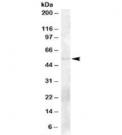 Western blot testing of human bone marrow lysate with TZFP antibody at 2ug/ml. Predicted molecular weight: ~53kDa.