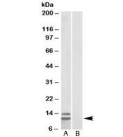 Western blot testing of human gastrointestinal cancer lysate and p15 INK4b antibody at 1ug/ml with [B] and without [A] immunizing peptide. Predicted/observed molecular weight: ~12kDa (isoform 2).