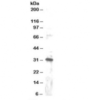 Western blot testing of Jurkat lysate with DKK4 antibody at 1ug/ml. Detection of the 30-32kDa form of the protein is observed. (1)
