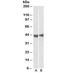 Western blot testing of Jurkat [A] and MOLT4 [B] lysates with CD123 antibody at 2ug/ml. Predicted molecular weight ~43kDa.