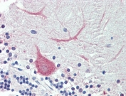 IHC testing of FFPE human cerebellum tissue with TRIM71 antibody at 3.75ug/ml. Required HIER: steamed antigen retrieval with pH6 citrate buffer; AP-staining.