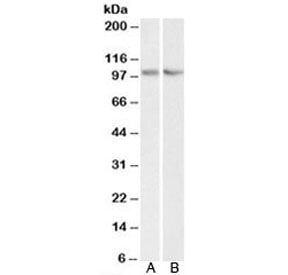 Western blot testing of human HEK293 [A] and mouse NIH3T3 [B] lysate with TRIM71 antibody at 0.3ug/ml. Predicted molecular weight: ~93kDa.~