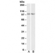 Western blot testing of human HEK293 [A] and mouse NIH3T3 [B] lysate with TRIM71 antibody at 0.3ug/ml. Predicted molecular weight: ~93 kDa.
