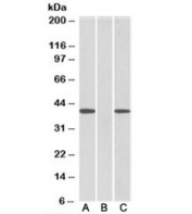 Western blot of HEK293 lysate overexpressing human FANCF-MYC probed with FANCF antibody [0.5ug/ml] in Lane A and anti-MYC [1/1000] in lane C. Mock-transfected HEK293 probed with FANCF antibody [1ug/ml] in Lane B. Predicted molecular weight: ~42kDa.