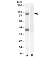 Western blot testing of human cerebellum lysate with EPB4IL2 antibody at 0.1ug/ml with [B] and without [A] blocking/immunizing peptide. Predicted/observed molecular weight: ~110kDa. Both observed bands are blocked by addition of immunizing peptide.