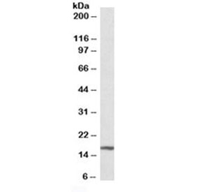 Western blot testing of mouse liver lysate with p16INK4a antibody at 0.3ug/ml. Predicted molecular weight ~16kDa.~