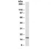 Western blot testing of mouse liver lysate with p16INK4a antibody at 0.3ug/ml. Predicted molecular weight ~16 kDa.