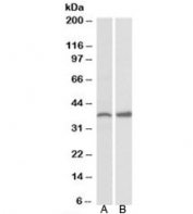 Western blot testing of mouse ovary (A) and rat uterus (B) lysate with PRKCDBP antibody at 0.3ug/ml. Predicted molecular weight: ~28kDa, routinely observed at 35-40kDa.