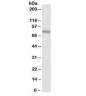 Western blot testing of rat kidney lysate with Crot antibody at 0.3ug/ml. Predicted molecular weight: ~70kDa.