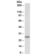 Western blot testing of human peripheral lymphocytes lysate with LAT2 antibody at 0.01ug/ml. Predicted molecular weight: 27kDa.