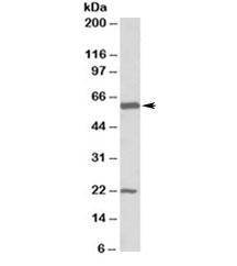 Western blot testing of human frontal cortex lysate with GLAST1 antibody at 0.1ug/ml. Molecular weight: the expected ~60kDa band and the additional ~22kDa band are both blocked by the immunizing peptide.