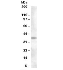 Western blot testing of human adrenal gland lysate with Proenkephalin antibody at 0.3ug/ml. Predicted molecular weight: ~31kDa, can also be observed at ~37kDa. (Ref 1)~