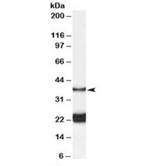 Western blot testing of rat spinal cord lysate with GALR1 antibody at 0.1ug/ml. Predicted molecular weight ~39kDa.