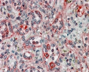 IHC staining of FFPE human spleen with TMX1 antibody at 4ug/ml. HIER: steamed with pH6 citrate buffer, AP-staining.