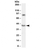 Western blot testing of human spleen lysate with HCST antibody at 0.2ug/ml. HCST is a 93 amino acid protein that complexes with NKG2D to be visualized by western blot at ~40kDa. Both observed bands are blocked by addition of the immunizing peptide.