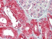 IHC testing of FFPE human kidney tissue with CHCHD3 antibody at 5ug/ml. Required HIER: steamed antigen retrieval with pH6 citrate buffer; AP-staining.