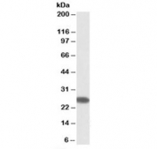 Western blot testing of human placenta lysate with CHCHD3 antibody at 0.3ug/ml. Predicted molecular weight: ~26 kDa.