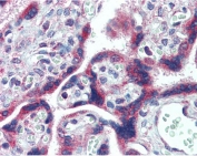 IHC testing of FFPE human placenta tissue with FMR1 antibody at 2.5ug/ml. Required HIER: steamed antigen retrieval with pH6 citrate buffer; AP-staining.