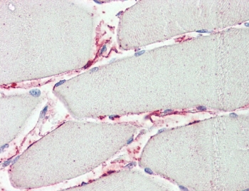 IHC testing of FFPE human skeletal muscle tissue with Peptidase inhibitor 15 antibody at 5ug/ml. Required HIER: