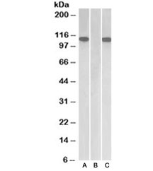 Western blot of HEK293 lysate overexpressing human Furin with MYC tag probed with Furin antibody [1ug/ml] in Lane A and probed with anti-MYC tag [1/1000] in lane C. Mock-transfected HEK293 probed with FURIN antibody [1ug/ml] in Lane B.