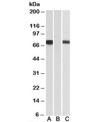 Western blot of HEK293 lysate over expressing human FOXC1-FLAG tested with FOXC1 antibody [1ug/ml] in Lane A anti-FLAG (1/3000) in lane C. Mock-transfected HEK293 tested with FOXC1 antibody [1ug/ml] in Lane B. Predicted molecular weight: ~57kDa.~