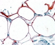 IHC testing of FFPE human pancreas with KIAA1881 antibody at 4ug/ml. HIER: steamed with pH6 citrate buffer, AP-staining. Membranous and cytoplasmic staining of adipocytes seen.