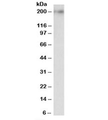 Western blot testing of rat brain lysate with Kalirin antibody at 0.1ug/ml. Predicted molecular weight: ~192kDa (isoform 2).