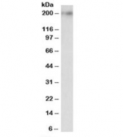 Western blot testing of rat brain lysate with Kalirin antibody at 0.1ug/ml. Predicted molecular weight: ~192 kDa (isoform 2).