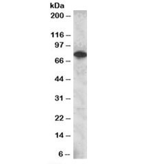 Western blot testing of Daudi lysate with SETMAR antibody at 2ug/ml. Predicted molecular weight: ~78kDa.