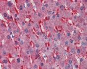 IHC testing of FFPE human liver with Frizzled 2 antibody at 2.5ug/ml. HIER: steamed with pH6 citrate buffer, AP-staining.