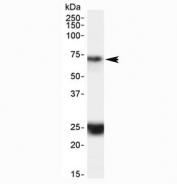 Western blot testing of human hippocampus lysate with HAP1 antibody at 0.1ug/ml. The expected ~70 kDa band and the additional ~25 kDa band are both blocked by the immunizing peptide.