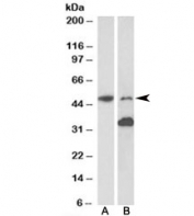 Western blot testing of mouse fetal (A) and adult (B) brain lysates with MKRN1 antibody at 1ug/ml. Observed molecular weight: 50~60kDa. The ~35kDa band may be the mouse equivalent to human isoform 2.