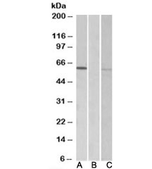 Western blot of HEK293 lysate over expressing human MKRN1-FLAG tested with MKRN1 antibody (0.3ug/ml) in Lane A and tested with anti-FLAG (1/1000) in lane C. Mock-transfected HEK293 probed with MKRN1 antibody (1ug/ml) in Lane B. Observed molecular weight: 50~60kDa.~
