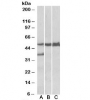 Western blot of human liver lysate (lane 1), mouse liver lysate (lane 2) and rat liver lysate (lane 3) with LSP1 antibody at 0.05ug/ml. Predicted molecular weight: ~37kDa but is routinely observed at ~52kDa (PMID: 15684321).