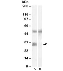 Western blot testing of human breast cancer lysate with IGFBP3 antibody at 0.02ug/ml with [B] and without [A] blocking/immunizing peptide. The glycoprotein is visualized between molecular weight 29~41kDa.