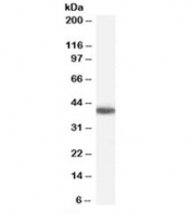 Western blot testing of human heart lysate with GALR2 antibody at 0.3ug/ml. Predicted molecular weight ~42kDa.