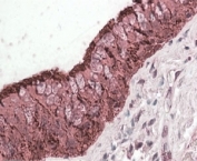 IHC staining of FFPE human lung with ALDH3A1 antibody at 4ug/ml. HIER: steamed with pH6 citrate buffer, AP-staining.