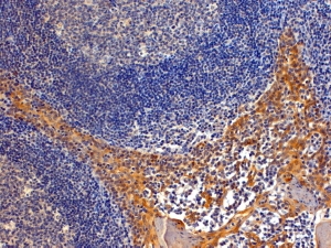 IHC testing of FFPE human tonsil with Importin 8 antibody at 4ug/ml. HIER: steamed with pH9 Tris/EDTA buffer, HRP-staining.
