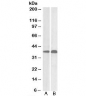 Western blot testing of Daudi (A) and MOLT4 (B) cell lysate using SET antibody at 0.01ug/ml. Predicted molecular weight: 32kDa.