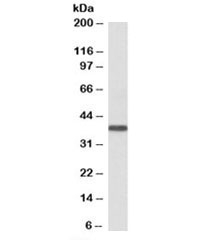 Western blot testing of human kidney lysate with SET antibody at 0.3ug/ml. Predicted molecular weight: 32kDa.~