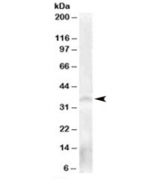 Western blot testing of human testis lysate with NANOS antibody at 0.3ug/ml. Predicted molecular weight: ~30kDa but routinely observed at 35~40 kDa (see ref. 1).