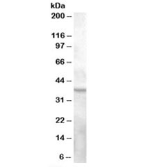 Western blot testing of human ovay lysate with GPR119 antibody at 0.3ug/ml. Predicted molecular weight ~37kDa.