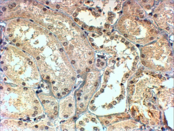 IHC testing of FFPE human kidney with TBLR1 antibody at 4ug/ml. HIER: steamed with pH9 Tris/EDTA buffer, HRP-staining.