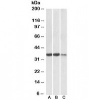 Western blot testing of heart [A], skeletal muscle [B] and kidney [C] lysates with LDHA antibody at 0.3ug/ml. Predicted molecular weight ~36kDa.