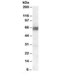 Western blot testing of human skeletal muscle lysate with BIN1 antibody at 0.1ug/ml. Predicted molecular weight: ~65kDa.