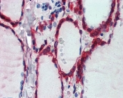 IHC testing of FFPE human thyroid gland tissue with PRDX1 antibody at 2.5ug/ml. Required HIER: steamed antigen retrieval with pH6 citrate buffer; AP-staining.
