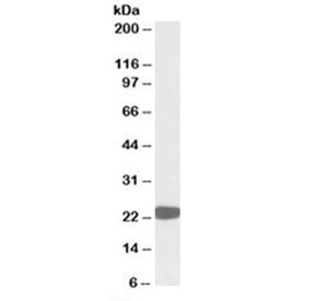 Western blot testing of HepG2 lysate with PRDX1 antibody at 0.01ug/ml. Predicted molecular weight: 22kDa.