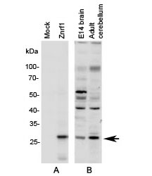 Western blot A: N2a cell lysate overexpressing mouse Znrf1 and Blot B: mouse brain lysates (embryo E14 and adult cerebellum) tested with Znrf1 antibody at 1ug/ml.~