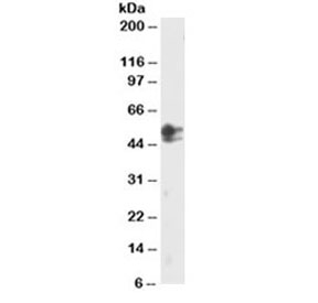 Western blot testing of HeLa lysate with SMAD2 antibody at 2ug/ml. The 467 AA and 437 AA isoforms may be detected with this Ab.~